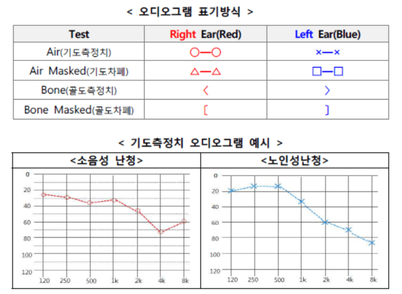 청력 손실 정도 표